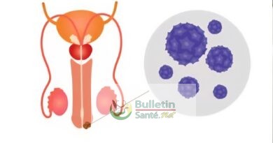 Papillomavirus : 17,7 % des hommes testés à Ouagadougou porteurs d’un HPV à haut risque